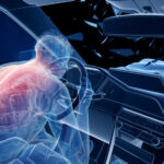 Spinal Cord Injury from car accident